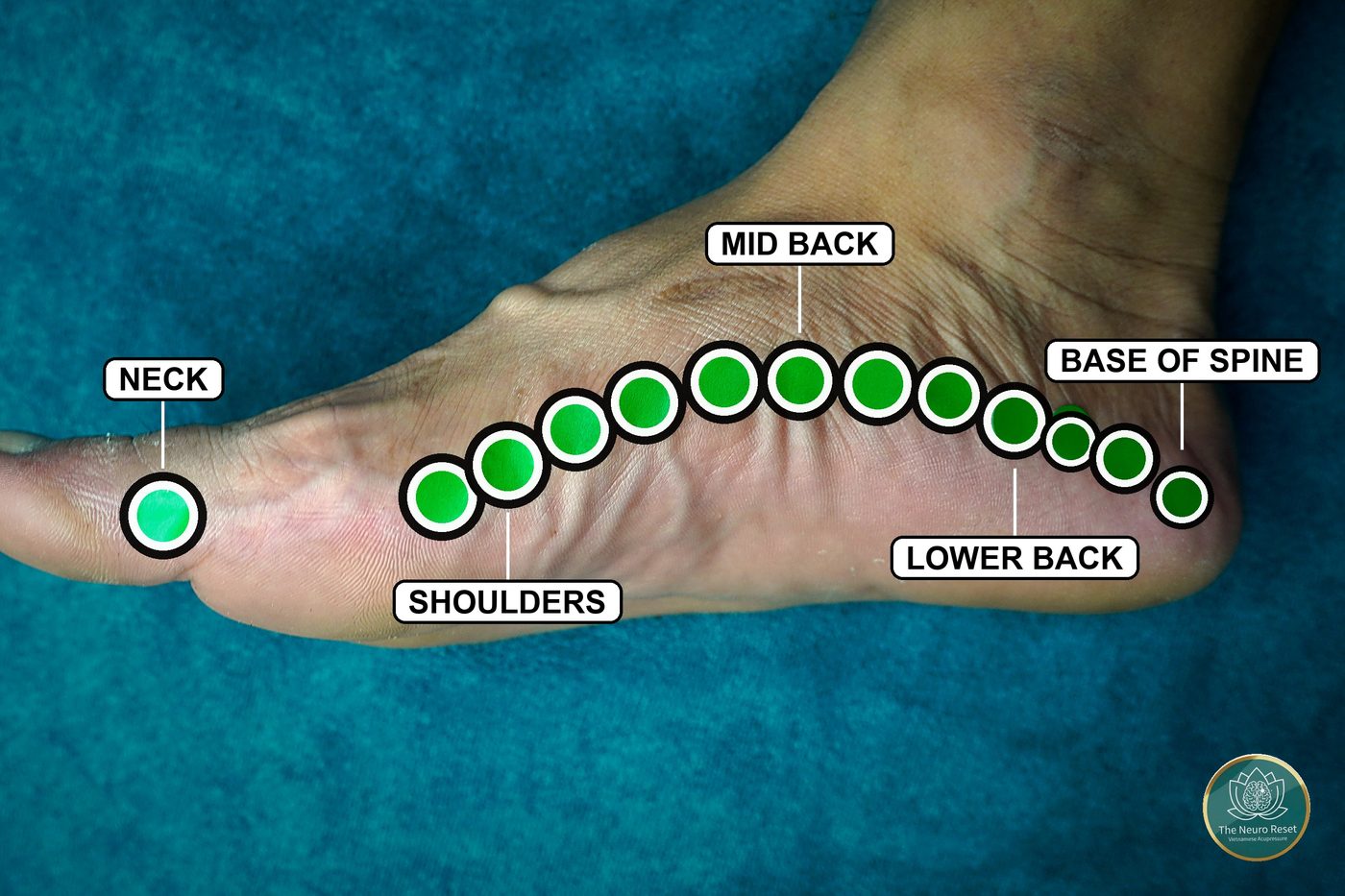The inside edge of a bare foot, labelled neck, shoulders, mid back, lower back and base of spine from the big toe back to the heel