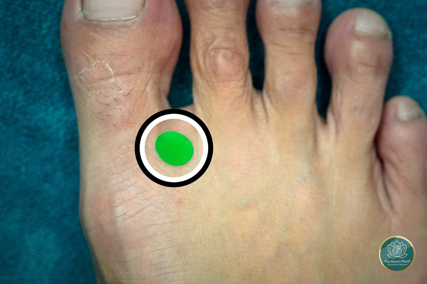 Thumb and finger squeezing and rolling the whole base of the big toe — the pressure point used for a sore or twisted neck.