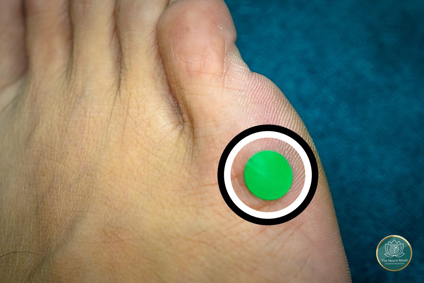 Thumb pressing on and right behind the raised knuckle at the base of the little toe — the pressure point used for shoulder pain.