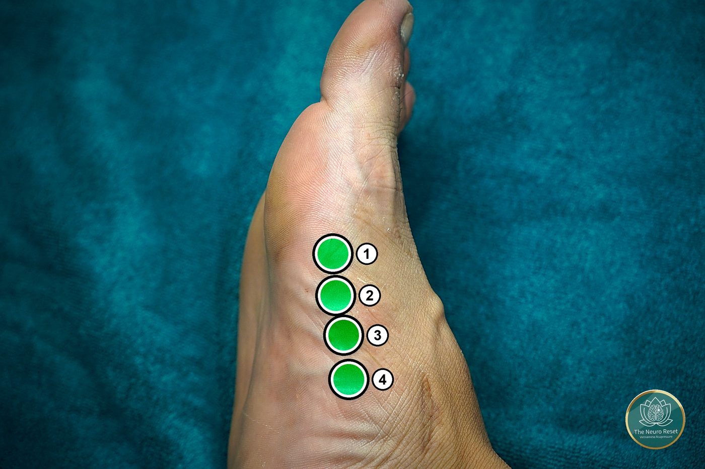 Thumb walking along the long inside edge of the foot, behind the big-toe knuckle — the pressure point used for pain between the shoulder blades.