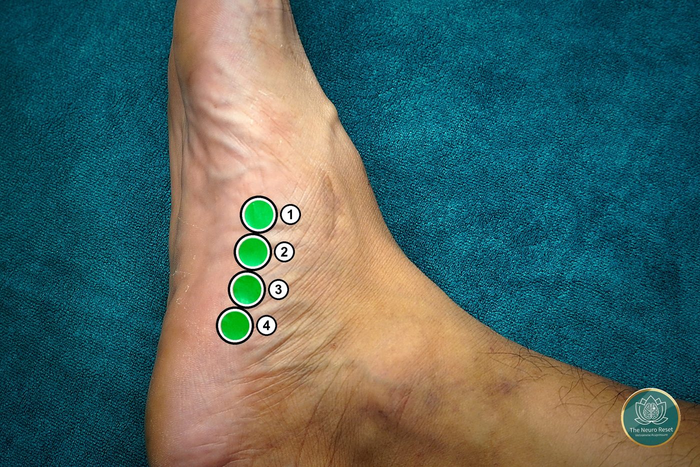 Thumb pressed into the hollow at the top of the foot's arch — the pressure point used for lower back pain.