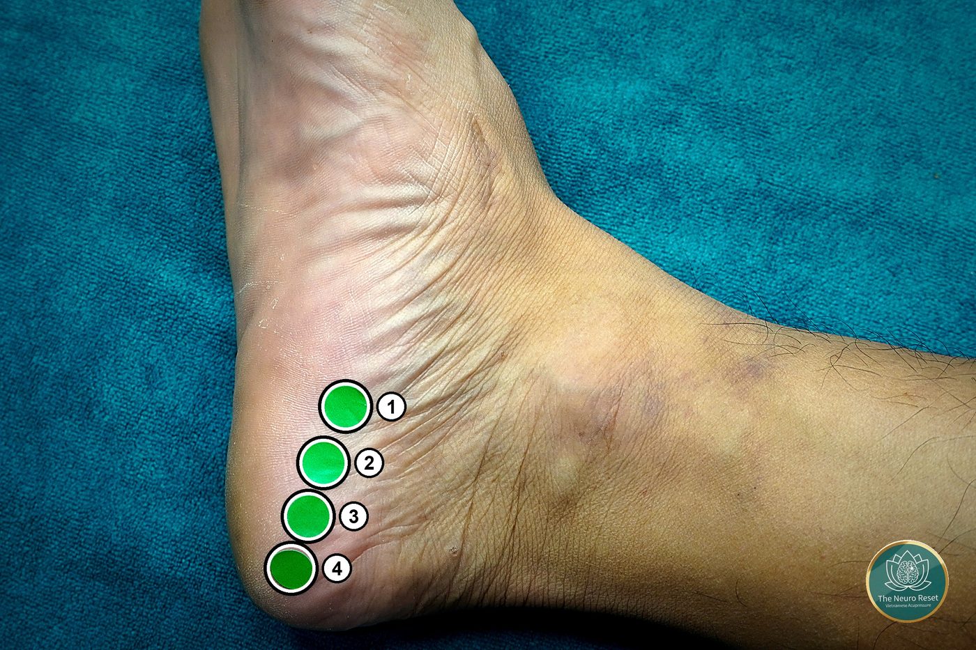 Thumb pressing into the inner wall of the heel — the pressure point used for sciatica and pain at the base of the spine.