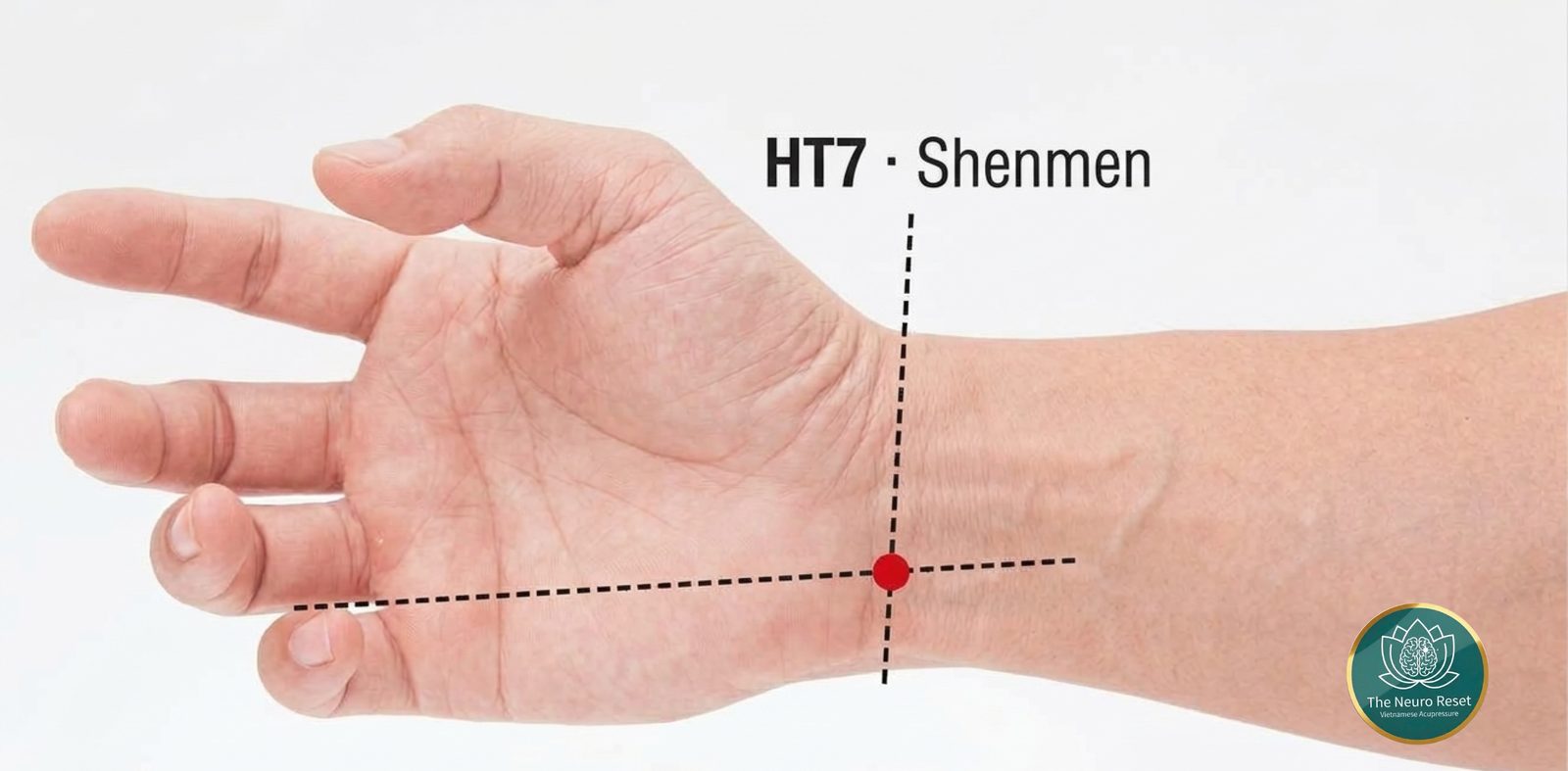 Shenmen (HT7) pressure point: an open hand, palm up, with a red dot on the wrist crease at the little-finger side, where two guide lines cross.